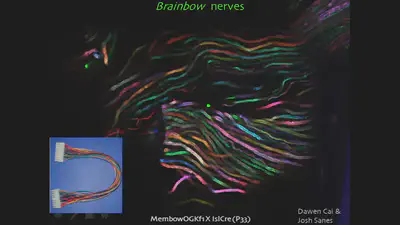 brainbownerves.jpg