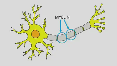 A neuron with healthy myelin sheath. SOURCE: https://neuroscientificallychallenged.com/glossary/myelin